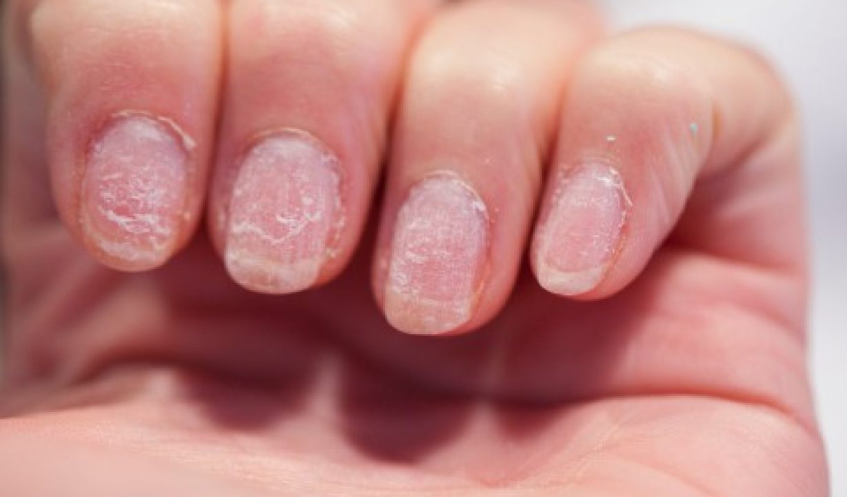 Why You Need to Stop Using Gels and Acrylics Right Now